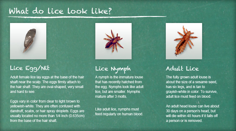 How To Recognize Lice | Lice Removal and Treatment | Ladibugs Clinic